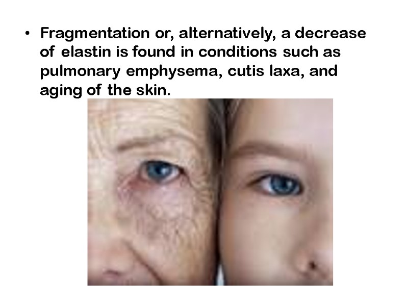 Fragmentation or, alternatively, a decrease of elastin is found in conditions such as pulmonary